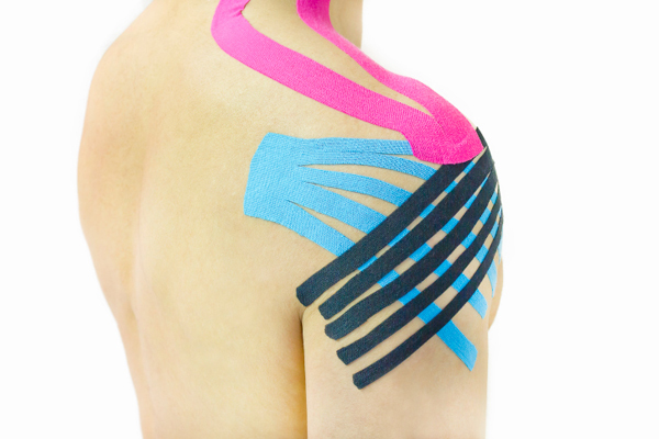 Kinesiotaping, è davvero utile?